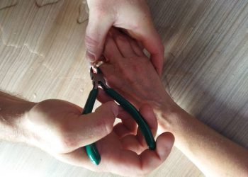 В Новороссийске женщина пришла к спасателям из-за вросшего в палец кольца