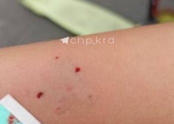 В Краснодаре сурикат напал на ребенка