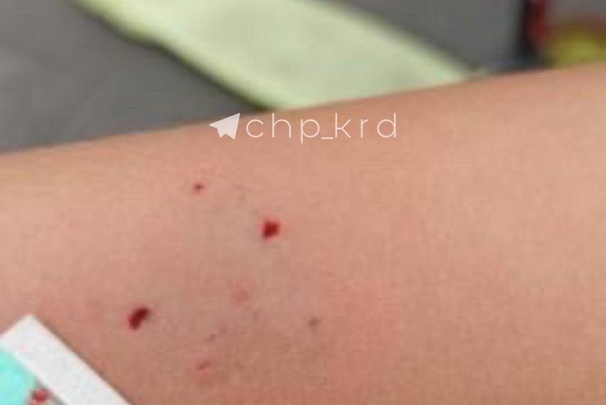 В Краснодаре сурикат напал на ребенка