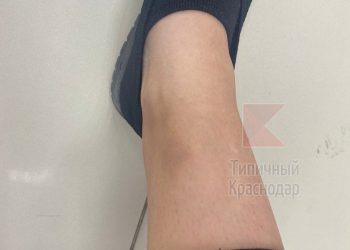 В Краснодаре на улице Грибоедова собака напала на человека