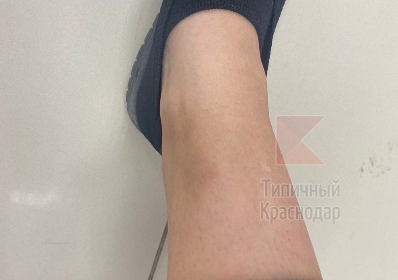 В Краснодаре на улице Грибоедова собака напала на человека