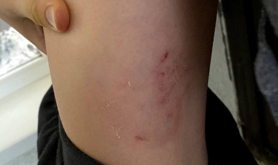 В Краснодаре бездомная собака напала на школьника