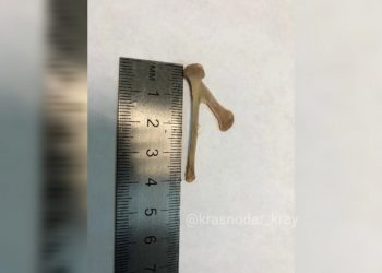 В Новороссийске полуторагодовалый ребенок стал задыхаться из-за куриной кости, застрявшей в пищеводе 