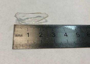 В Новороссийске 11-летний ребенок едва не задохнулся из-за проглоченной автомобильной фары