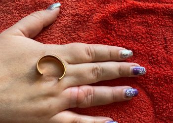 В Новороссийске спасатели сняли кольцо с пальца женщины