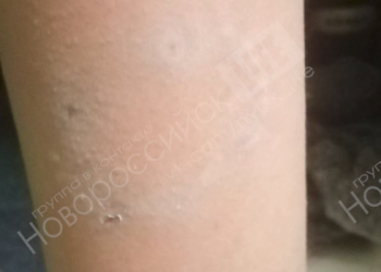 В Новороссийске отец покусанного собаками ребёнка записал видеообращение к администрации