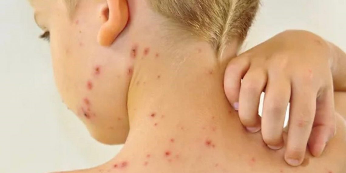 В Краснодарском крае циркулирует высокозаразная болезнь