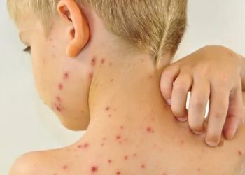 В Краснодарском крае циркулирует высокозаразная болезнь