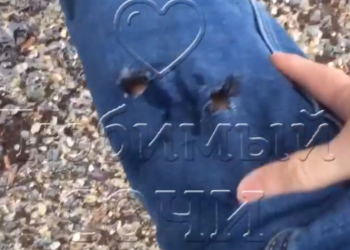 Без уколов не обойтись: в Сочи собака укусила мужчину