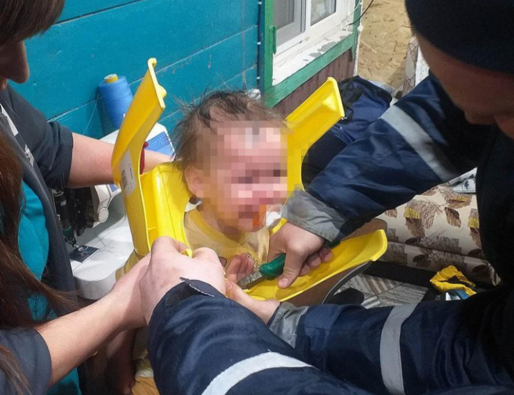 На Кубани еще один ребенок оказался в ловушке, надев на голову пластиковый горшок