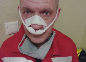 В Краснодаре мужчина сломал нос доктору, который вытащил его с того света