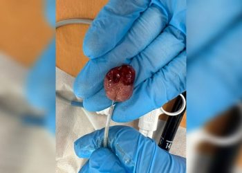 На Кубани спасли маленького мальчика, которого съедала кишечная опухоль