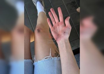 В центре Краснодара девушка выпала из автобуса