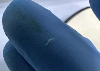 В Новороссийске юноша 20 раз в сутки ходил в туалет из-за клубка глистов