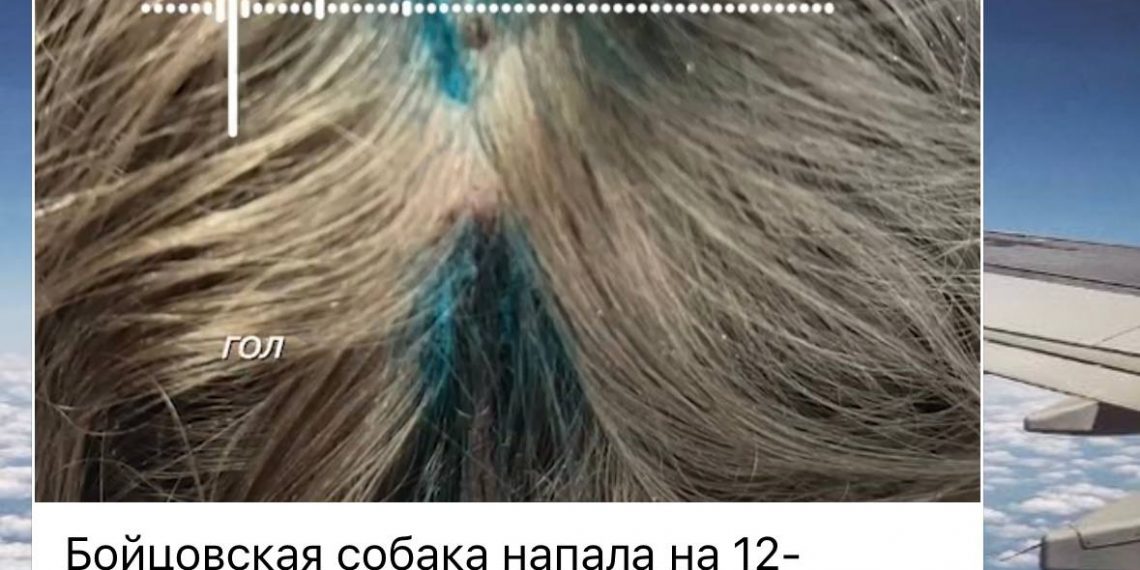 В Новороссийске разыскивают хозяина собаки, укусившей девочку на берегу озера