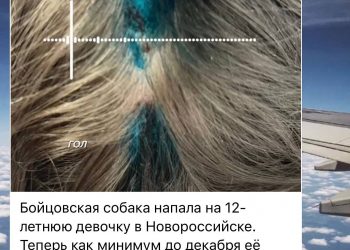 В Новороссийске разыскивают хозяина собаки, укусившей девочку на берегу озера