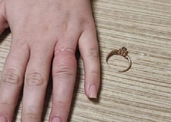 В Новороссийске спасатели избавили женщину от кольца