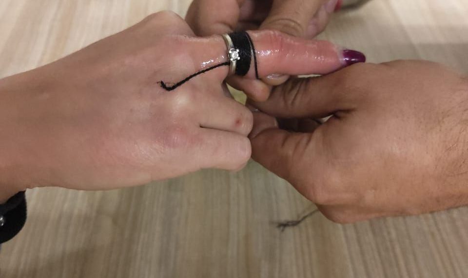 В Новороссийске жители стали массово забывать про украшения на руках