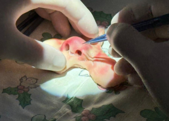 Собака откусила лицо 4-летнего мальчика. Врачи из Краснодара его восстановили