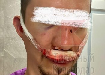 В Краснодаре неизвестные жестоко избили мужчину из-за замечания