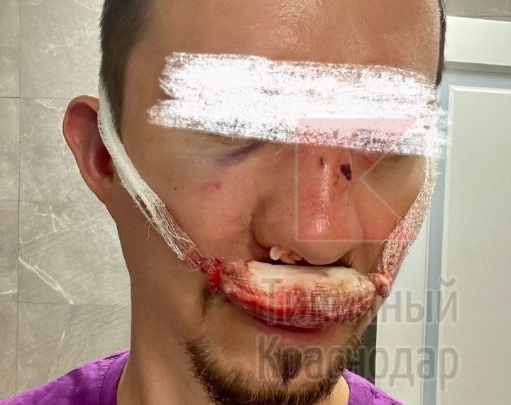 В Краснодаре неизвестные жестоко избили мужчину из-за замечания