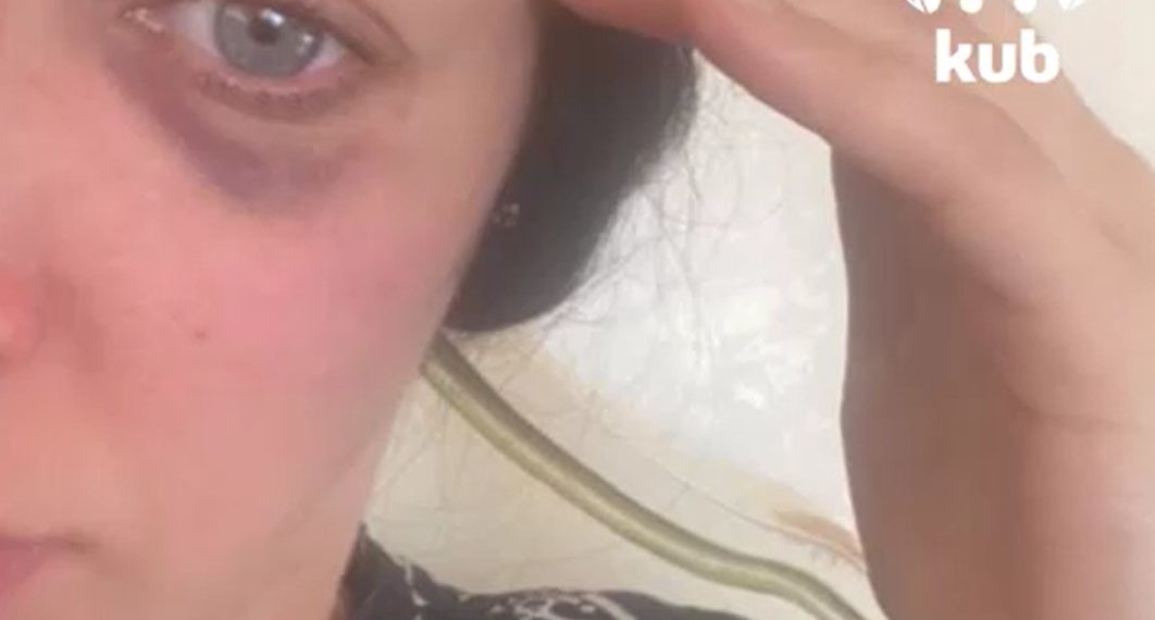 Краснодарка обвиняет сожителя-тирана в постоянных издевательствах и похищении ребенка