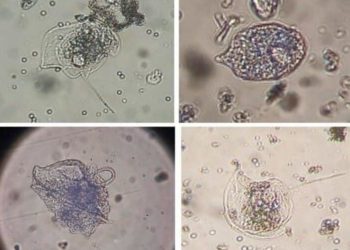 Научные сотрудники ЮНЦ РАН обнаружили новый вид токсичных водорослей в Черном море