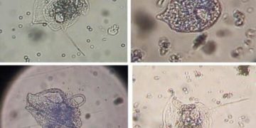 Научные сотрудники ЮНЦ РАН обнаружили новый вид токсичных водорослей в Черном море