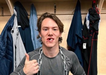 На матче сочинскому хоккеисту выбили несколько зубов