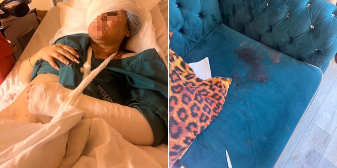 В Сочи мужчина гаечным ключом выбил глаз спящей возлюбленной