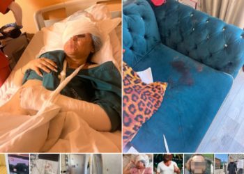 В Сочи мужчина гаечным ключом выбил глаз спящей возлюбленной