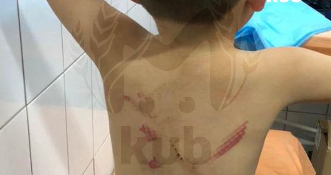 Куб Мэш: многодетная мать избивает 3-летнего сына в Тимашевске