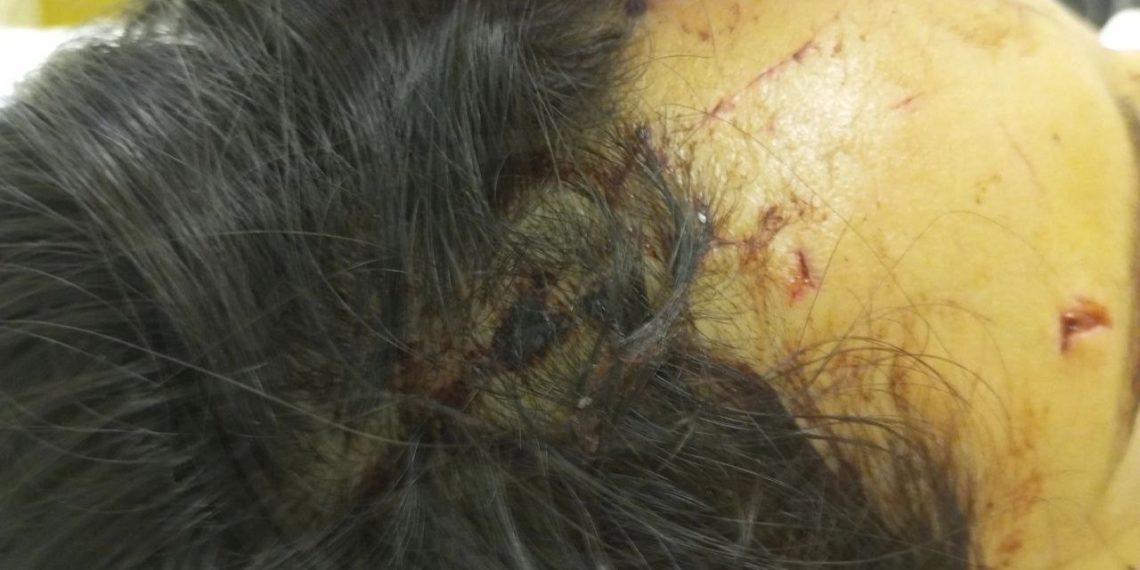 В Сочи из-за спора о парковочном месте жестоко избили девушку