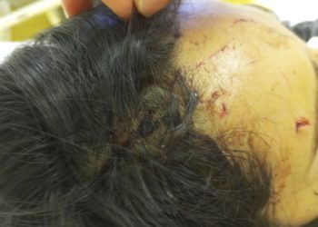 В Сочи из-за спора о парковочном месте жестоко избили девушку