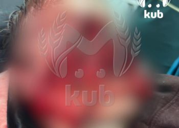 В Сочи две хаски напали и выгрызли часть лица ребенка