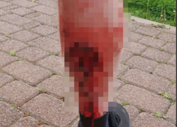 Бродячий пёс напал на пенсионера в Юбилейном микрорайоне Краснодара