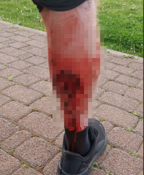 Бродячий пёс напал на пенсионера в Юбилейном микрорайоне Краснодара