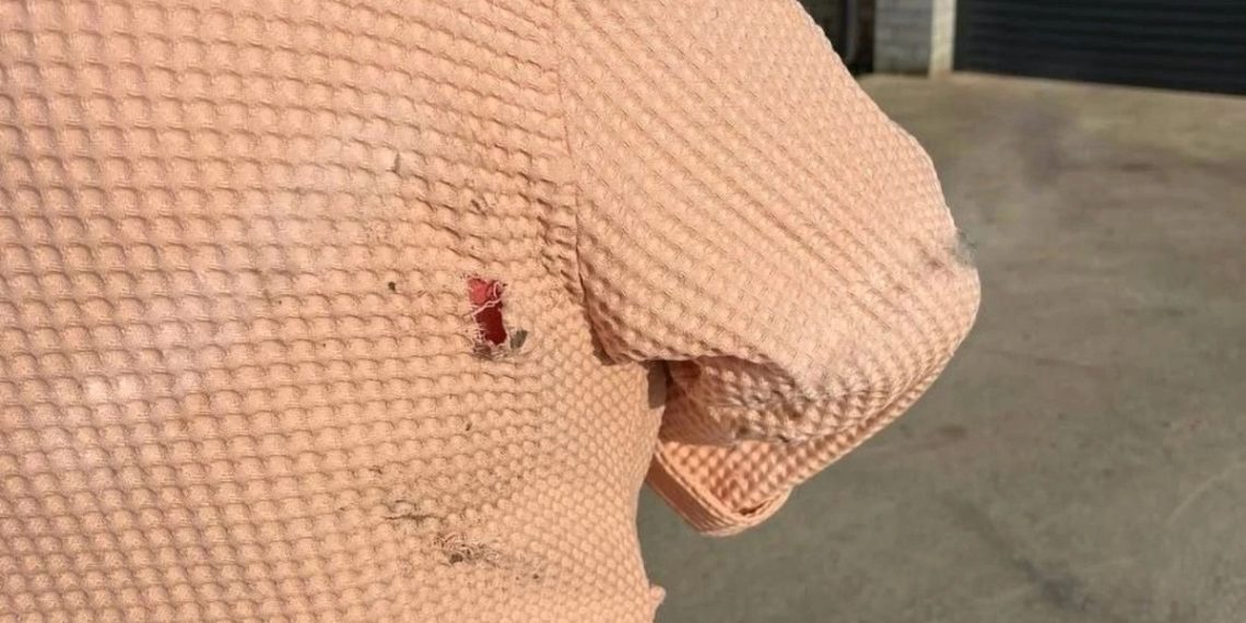 Краснодарка подверглась нападению собак в поселке «Крепость» утром