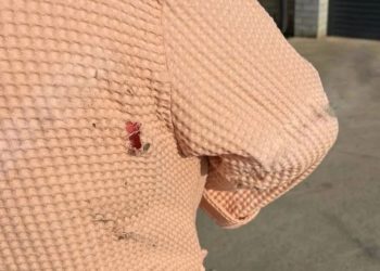 Краснодарка подверглась нападению собак в поселке «Крепость» утром