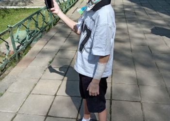 Покусанному хаски Вале Королёву из Сочи сняли швы, он вышел на прогулку