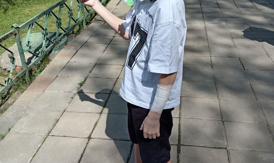 Покусанному хаски Вале Королёву из Сочи сняли швы, он вышел на прогулку