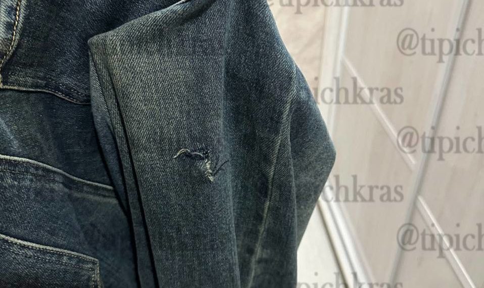 В Краснодаре собаки покусали школьницу, прикрывшую собой младшую сестру