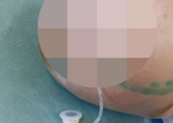 В лечении покусанного хаски Вали Королёва из Сочи начался новый этап