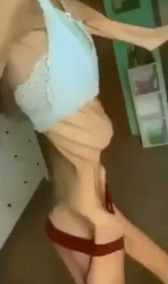 В Краснодаре студентка стала «ходячим скелетом», пытаясь спасти брак