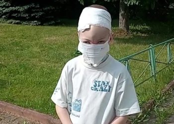 Стало известно, как выглядит покусанный хаски мальчик из Сочи спустя три месяца