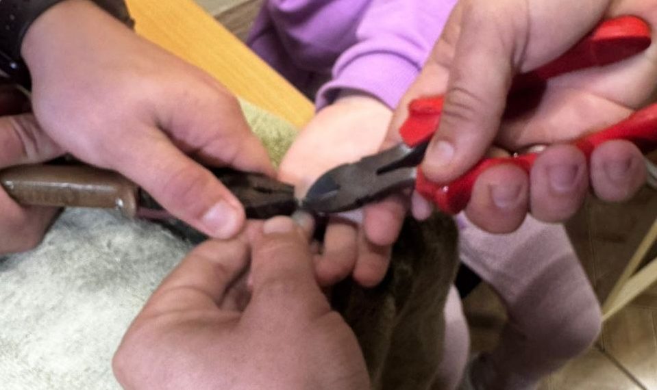 В Новороссийске спасли девочку, надевшую шайбу на палец