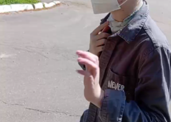 Юный Валя Королев из Сочи борется за новое лицо после нападения хаски