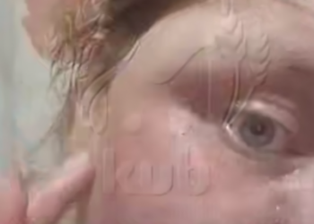 Беременная женщина в Краснодаре час ждала помощь после нападения