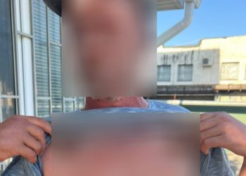 Жителя Кубани арестовали за татуировки с запрещенной символикой