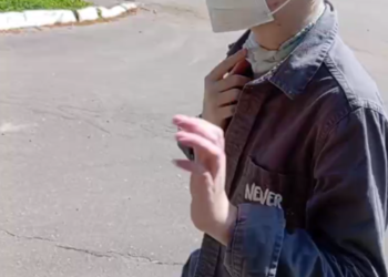 Уникальная операция спасла лицо 9-летнего Вали из Сочи: сняты последние повязки